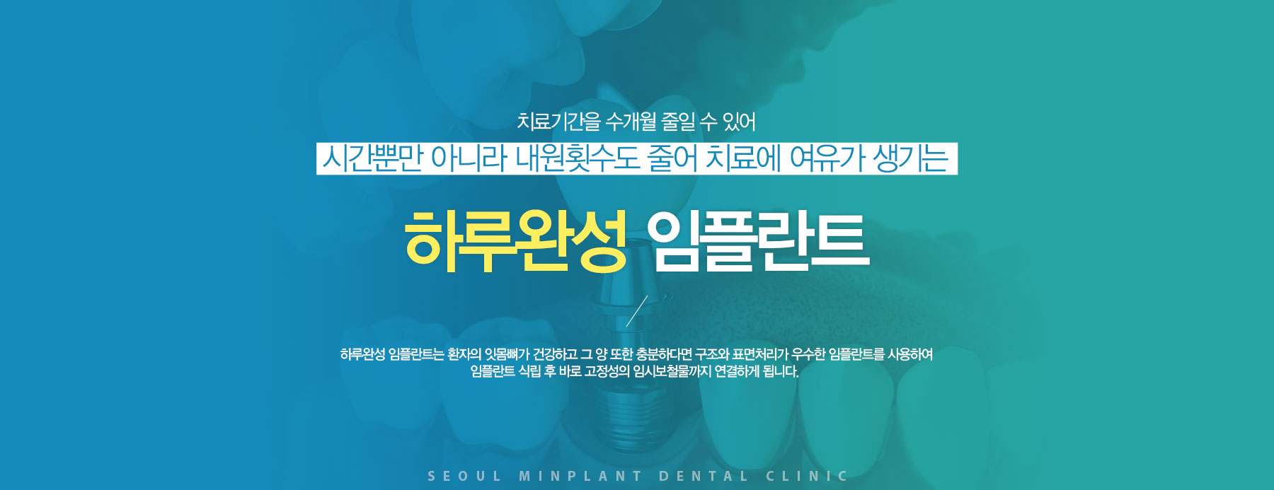 Ϲ öƮ öƮ ĸ Ŀ Ʒ 3~4,  4~6 ̻ ҿǴ  ġԴϴ. ̴ öƮ ո  յǱ  ðԴϴ. 
 Ϸϼ öƮ ȯ ո ǰϰ    ϴٸ  ǥó  öƮ Ͽ öƮ ĸ  ٷ  ӽúö ϰ ˴ϴ.